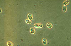 Chromatium okenii