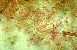 Chromatium spp.